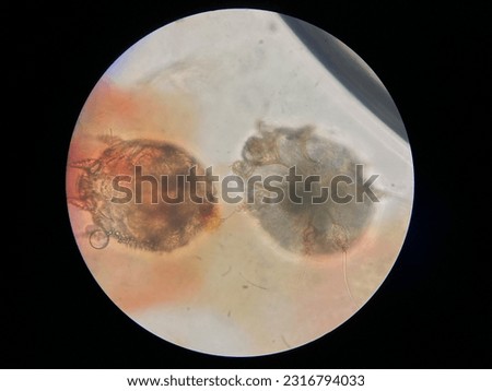 Notoedres cati under the microscope. Notoedric mange, also referred to as Feline scabies, is a highly contagious skin infestation caused by an ectoparasitic and skin burrowing mite Notoedres cati.