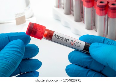 Prueba de anticuerpos clínicos del coronavirus novedoso y concepto de diagnóstico de Covid-19 con un médico que sostiene una muestra de plasma sanguíneo utilizada para probar el antígeno del SARS-CoV-2 con un cheque rojo en el recuadro positivo