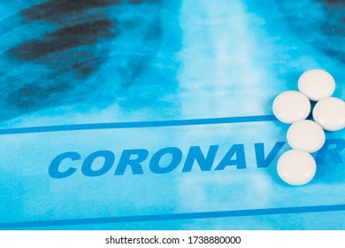 Novel Covid-19, Coronavirus. Infected Lungs Radiology Blue Image Background, With White Chloroquine Pills On It.