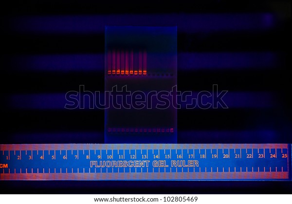 Nuclear and mitochondrial DNA\
separated by electrophoresis on an agarose gel. Detection by\
addition of Ethidium Bromide becoming fluorescent under the UV\
light.