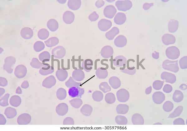 Nucleated Red Blood Cell Stock Photo Edit Now 305979866