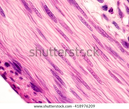 Nuclei of smooth muscle cells. These cells show a very elongated fusiform nucleus which contains small nucleoli. H&E stain.