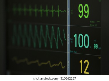 numbers and waveforms on the eCG monitor during surgery