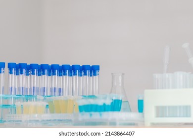 Numerous test tubes are used within epidemiological centers for research into the treatment of coronavirus. (COVID-19) that is spreading, causing many people to be infected.