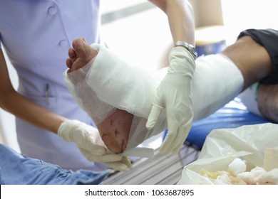 Nurse Change The Dressing Of Wound At Emergency Room