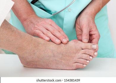 Nurse Checking Problems With Foot - Hallux, Closeup