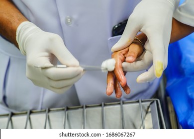 Nurse Cleaning  Wound On Patient Hand At Emergency  Room.