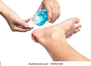 Nurse Cleaning Wound On Patient With  Isopropyl Alcohol Isolated In White Background Clipping Path