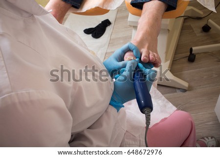 Nurse cure nail