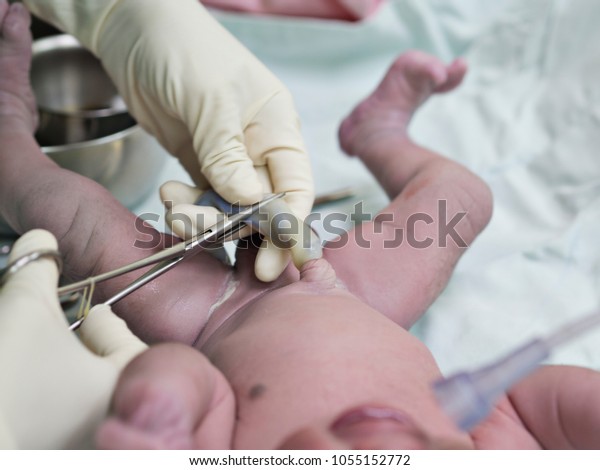Nurse or doctor hands\
wearing sterile gloves, cleaning and clamping newborn umbilical\
cord on a radiant warmer in labour room or nursery care unit in\
hospital