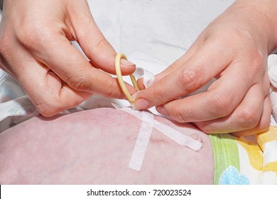 Nurse Is Fixing Gastrostomy Tube With Medical Patch In Postoperative Period Of Newborn Baby With Esophageal Atresia In Neonatal Intensive Care Unit At Children's Hospital.