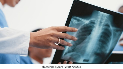 Nurse, hands and x ray analysis in hospital, professional consultation and teamwork collaboration for medical results. Radiology, film and examine respiratory system, diagnosis and people discussion - Powered by Shutterstock