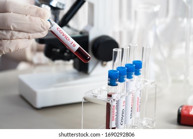 Nurse Holding Test Tube With Blood For NCoV-2019 Analyzing, Coronavirus Test Concept In Laboratory