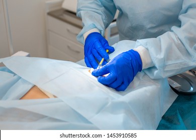 A Nurse Makes An Injection For Local Anesthesia At The Surgical Site. Surgery To Remove Moles In A Private Clinic.