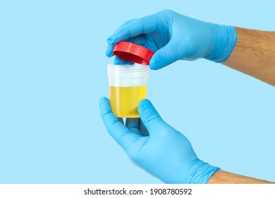 Nurse opening urine sample container for medical urinalysis. Healthcare and medicine concept