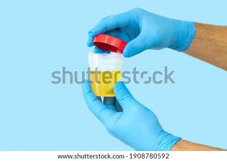 Nurse opening urine sample container for medical urinalysis. Healthcare and medicine concept