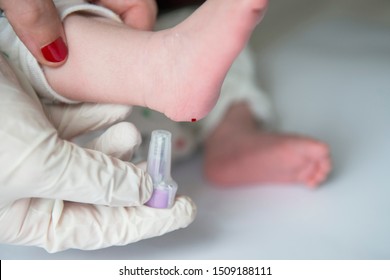 Nurse Performing The Neonatal Heel Prick Test
