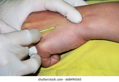 A Nurse Is Putting The Needle At Patient Hand To Take The Blood For HIV Test.