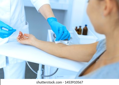 The Nurse Rubs The Hand With Alcohol Before Taking Blood From A Vein For Testing. Disinfects The Place Of Introduction Of A Needle With Antiseptic.