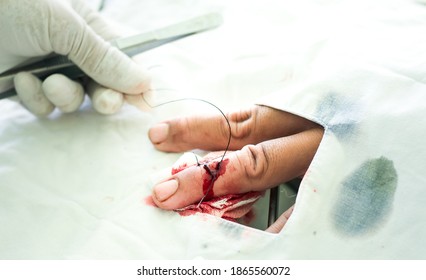 Nurse Taking Care And Suturing  The Wound On The Finger At Public Health Center