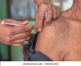 Nurses Are Being Vaccinated Against Tetanus,  The Old Man Hit By The Cuts.