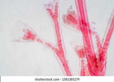 Obelia Is A Genus Of Hydrozoa, A Class Of Mainly Marine And Some Freshwater Animal Species That Have Both Polyp And Medusa Stages In Their Life Cycle. Educaion Of Biology.