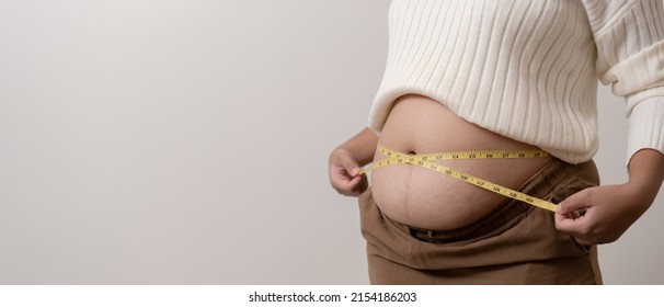 An Obesity Using Measuring Tape To Show The Real Size. Chubby Fat Woman Using Measure Tape At Belly. Real Size Woman After Gave Birth To Baby, Real Skin With Wrinkles And Scars. 