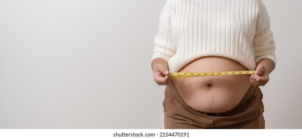 An Obesity Using Measuring Tape To Show The Real Size. Chubby Fat Woman Using Measure Tape At Belly. Real Size Woman After Gave Birth To Baby, Real Skin With Wrinkles And Scars. 