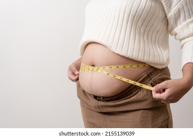 An Obesity Using Measuring Tape To Show The Real Size. Chubby Fat Woman Using Measure Tape At Belly. Real Size Woman After Gave Birth To Baby, Real Skin With Wrinkles And Scars. 