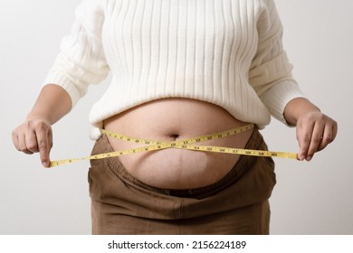 An Obesity Using Measuring Tape To Show The Real Size. Chubby Fat Woman Using Measure Tape At Belly. Real Size Woman After Gave Birth To Baby, Real Skin With Wrinkles And Scars. 