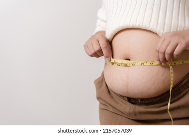 An Obesity Using Measuring Tape To Show The Real Size. Chubby Fat Woman Using Measure Tape At Belly. Real Size Woman After Gave Birth To Baby, Real Skin With Wrinkles And Scars. 