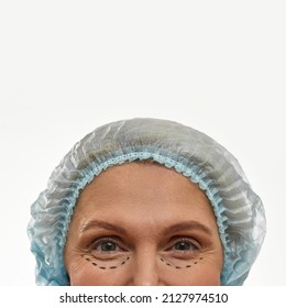 Obscure Face Of Middle Aged Woman Wearing Medical Cap With Puncture Lines On Her Face. Caucasian Female Looking At Camera. Plastic Surgery Concept. Isolated On White Background In Studio. Copy Space