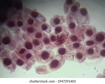 Observation Of Blood Cels From A Microscope