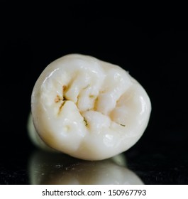 1,467 Occlusal surface Images, Stock Photos & Vectors | Shutterstock