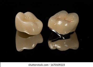The occlusal surface and margin comparison between full zirconia crown and a metal ceramic/porcelain jacket dental crown with a dark background and reflection