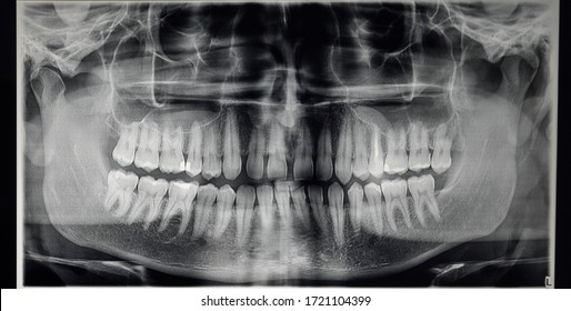 odontostomalogical radiographs, digital orthopantomography for dental diagnosis 