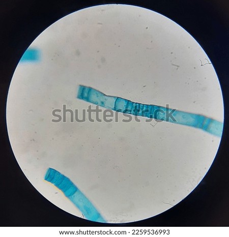 Oedogonium sp under the light microscope