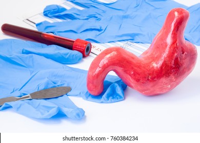 Oesophagus, Stomach, Duodenal Or Common Abdominal Surgery Concept. Shape Of Stomach Is Near Scalpel, Surgical Gloves And Blood Test Tube With Result. Indications For Surgery And Surgical Operation