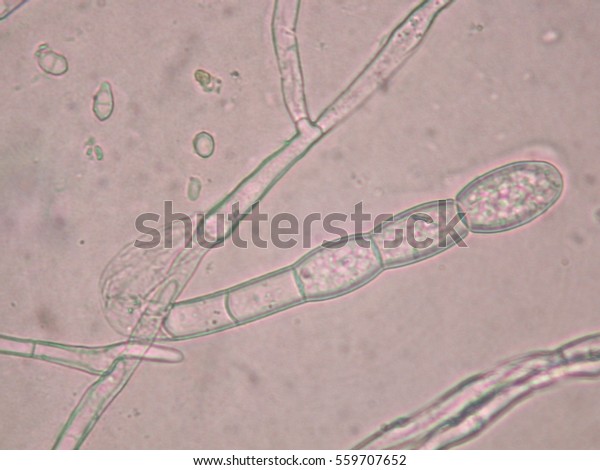 Oidium Spores Stock Photo (Edit Now) 559707652