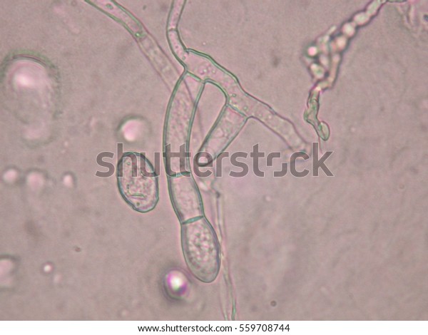 Oidium Spores Stock Photo (Edit Now) 559708744