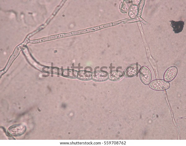Oidium Spores Stock Photo (Edit Now) 559708762