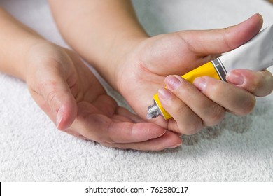 Ointment On Hand. Applying The Ointment And Emollient Cream In The Treatment And Hydration Of The Skin .