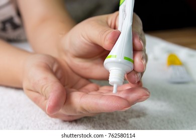 Ointment On Hand. Applying The Ointment  In The Treatment And Hydration Of The Skin. 