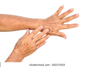 Old Asian Female Hands Full Of Freckles