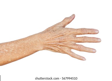 Old Asian Female Hands Full Of Freckles And Wrinkles / Aging Concept       