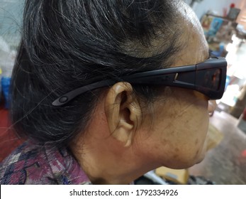 Old Chubby Senior Woman Wear Sunglasses To Protect The Eyes From Wind And Light After Cataract Pterygium Surgery