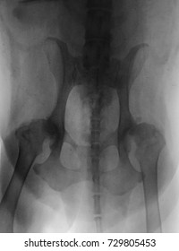 Old Dog X-ray Film Present Of Osteoarthritis, OA ,at Both Hip