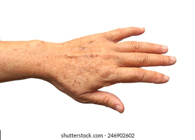 Old Female Hand With Freckles