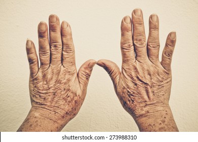 Old Female Hand Full Of Freckles With Vintage Tone