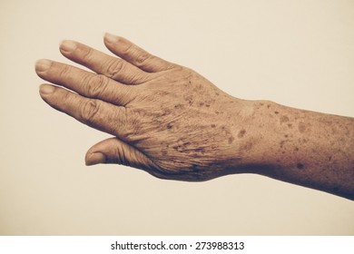 Old Female Hand Full Of Freckles With Vintage Tone